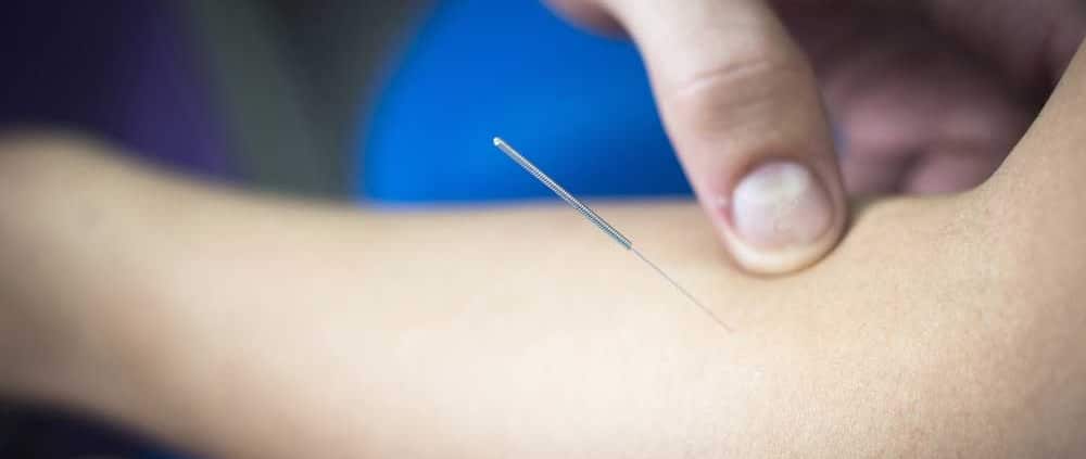 Dy needling tenniselleboog Dy needling tenniselleboog