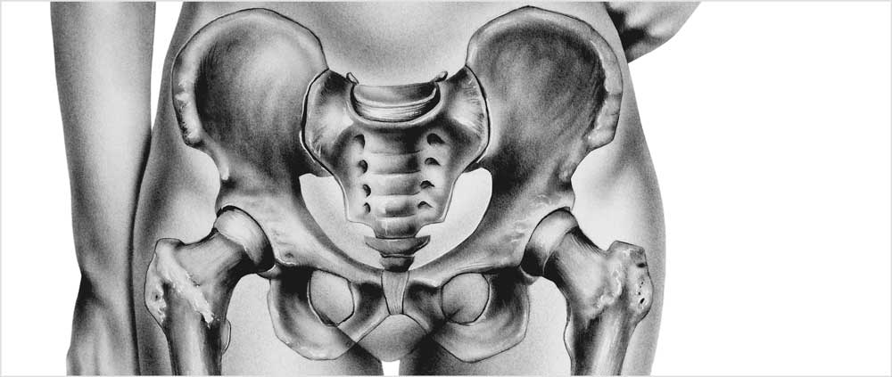 Last schaampijn Last schaampijn